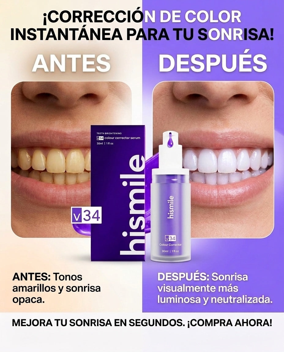 Antes y después con Hismile V34
