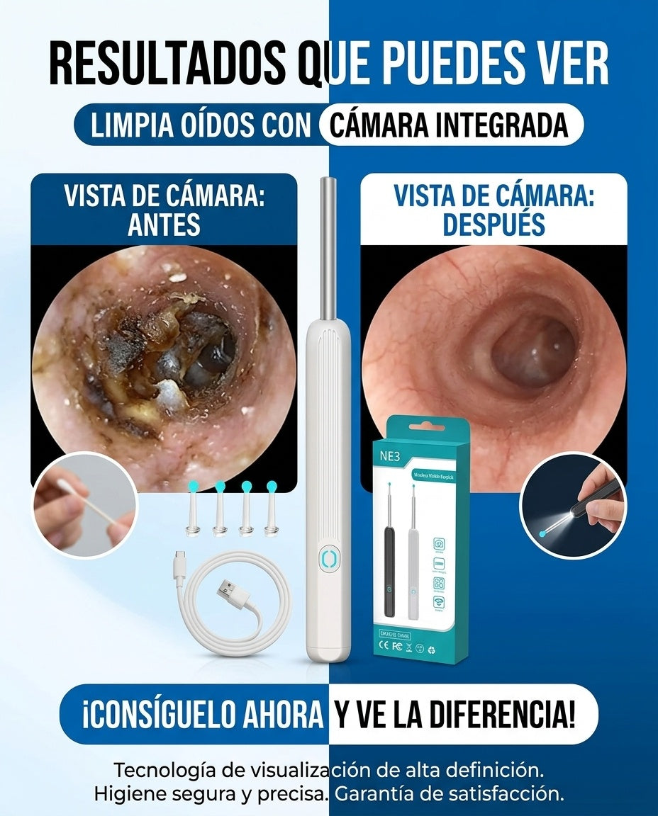 Limpiador de Oídos Inteligente Con Tecnología Avanzada y Cámara