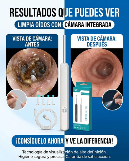 Limpiador de Oídos Inteligente Con Tecnología Avanzada y Cámara