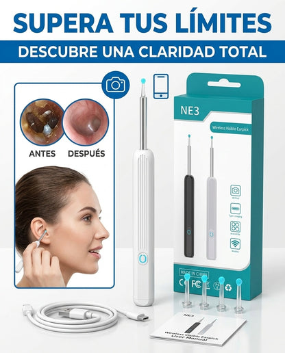 Limpiador de Oídos Inteligente Con Tecnología Avanzada y Cámara